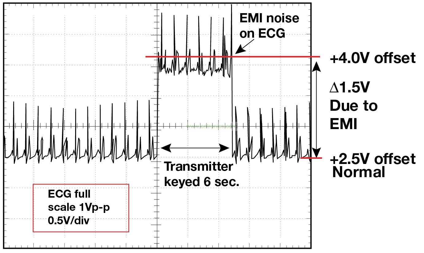 圖 1    1.5 英尺以外的發(fā)射器（f = 470 MHz, P= 0.5W）開啟和關閉時 ECG 診斷設備的心臟檢查結(jié)果