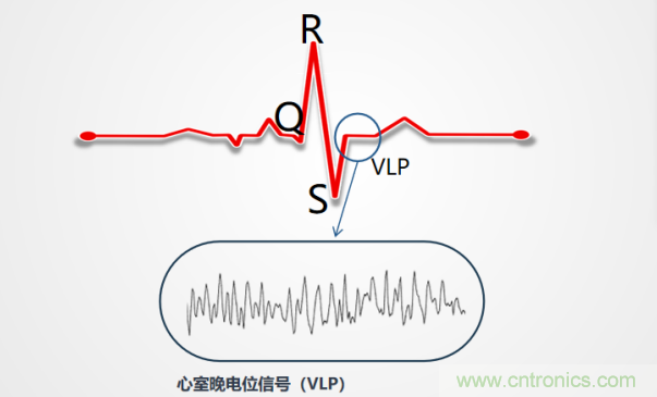 解決心電監(jiān)測行業(yè)難題，曼森伯格的濾波技術(shù)獲國家知識產(chǎn)權(quán)局發(fā)明授權(quán)